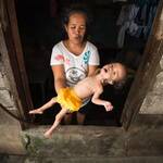 stunting-bansot