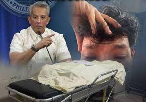 Mabagal na responde sa pasyente, isinisi sa LGU